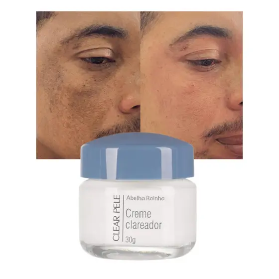 Hidratante Creme Facial Noite Manchas Clear Pele Abelha Rainha 30g