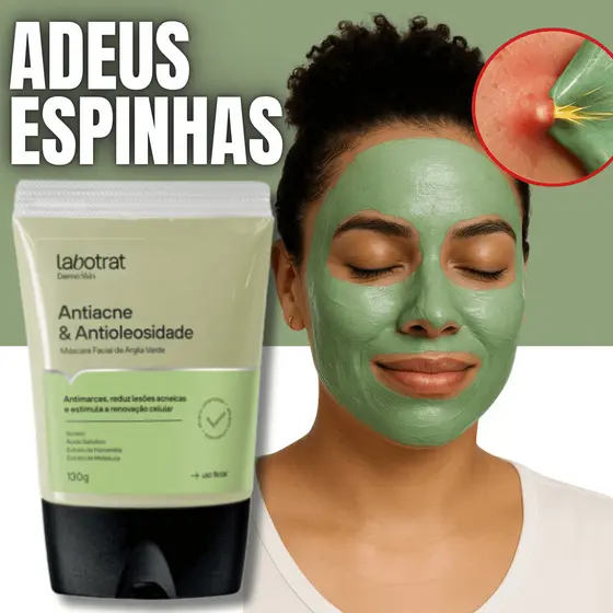 Máscara Antiacne oliosidade facial argila verde remove da pele cravos espinhas acnes