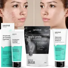 Kit antiacne espinhas cravos completo creme amolecedor sabonete esfoliante mascara facial argila