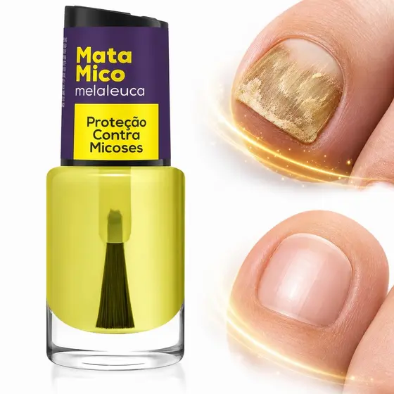 Óleo Anti micose Unhas Melaleuca Proteção Antifúngica Saúde Unhas Hidratação Barreira Protetora esmalte base