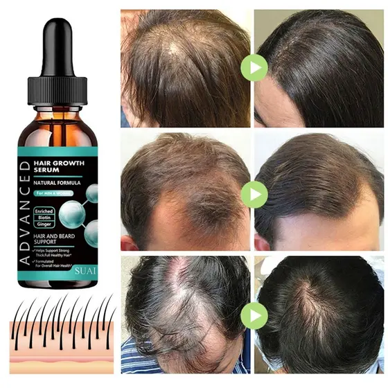 Óleo De Barba Para Crescimento Capilar , Rápido Do Cabelo