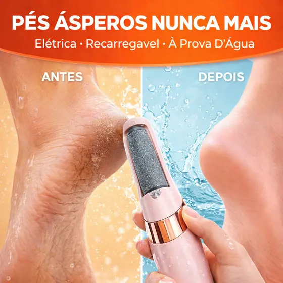 Lixa de Pé Elétrica Recarregável USB Bivolt À Prova D’Água Removedor de Calos Portátil