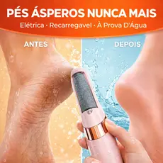Lixa de Pé Elétrica Recarregável USB Bivolt À Prova D’Água Removedor de Calos Portátil