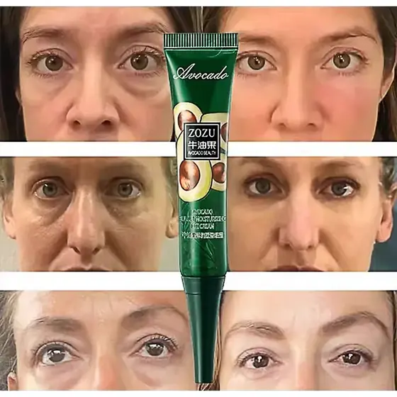 Creme Antirrugas Olhos Ação Instantânea Anti-Idade Reduz Rugas Linhas Finas Hidratante Premium Skincare