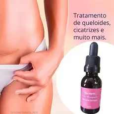 Óleo Vegetal De Rosa Mosqueta 100% Natural 30ml Hidrata Clareia Antissinais 75/120  * Categoria Beleza >