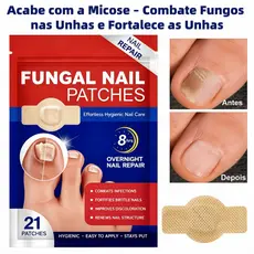 Adesivo Micose Unha Antifúngico–Corrige Unha Escura Espessa e Danificada Reparo e Proteção 21 Placas