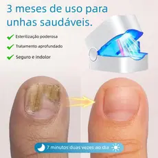 Tratamento de Onicomicose da Ponta do Dedo - Dispositivo a Laser e Luz Infravermelha para Fungos nas Unhas