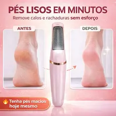 Lixa Elétrica para Pés USB Removedor de Calos Calcanhar Recarregável Sem Fio