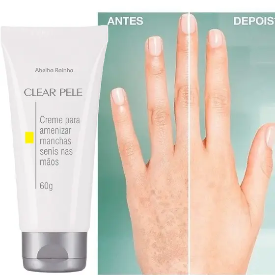 Creme Para Amenizar Marcas Senis Nas Mãos Clear Pele Abelha Rainha 60g - Clareador de Manchas Senis