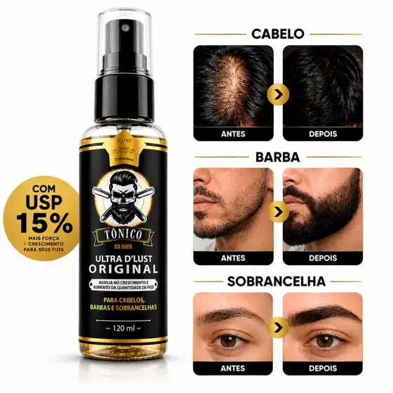 Tônico Capilar UltraMinox Crescimento Barba Cabelo Sobrancelha 120ml
