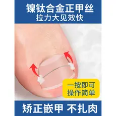 Corretor de unhas dedicado inflamação da unha adesivo de unha encravada artefato de unha encravada conjunto corretor de 
