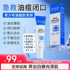 Shubechen limpeza creme de remoção de acne oficial autêntico remoção de acne acne pele desbotamento marca de acne remove