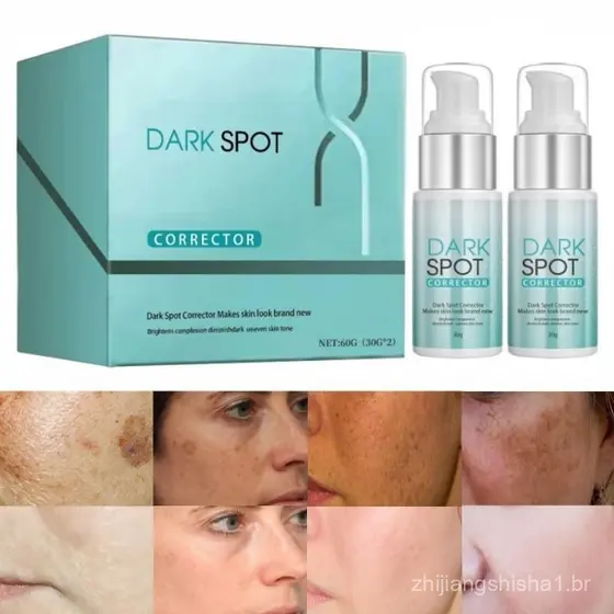2 Conjuntos (Caixa com 60 Gramas) de Creme Clareador Facial, Creme Reparador de Manchas Escuras, Creme para Manchas Escu
