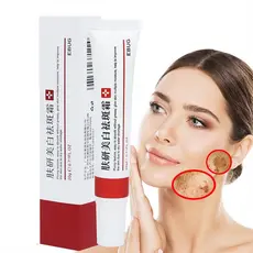Creme Clareador Para Remover Melasma Remove Manchas Escuras, Remove Melanina, Remove Melasma, Pele Brilhante