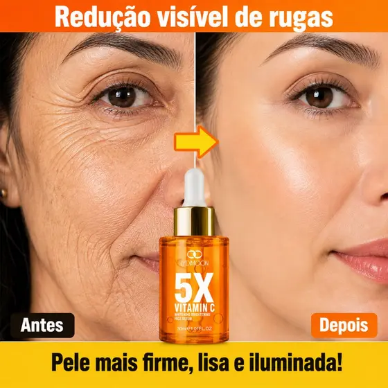 Serum facial com 5X Vitamina C Anti-rugas e Anti-envelhecimento , firmador e hidratante, Clareador de Manchas 30ml