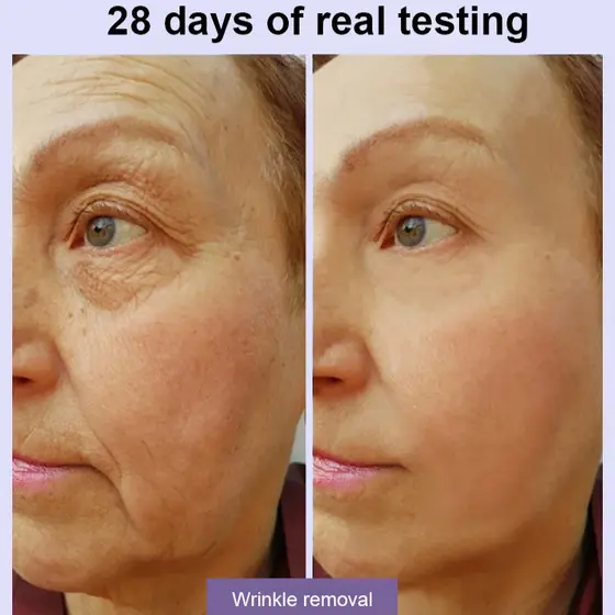 Máscara Facial Antirrugas Hidratação Profunda Para Linhas Finas E Rugas