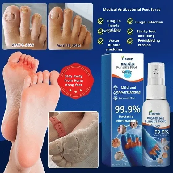 【Proteção Eficaz】Medical Foot Spray Fungal Repair Spray for Rotten Nails/Spray Antifúngico/Solução para Fungos