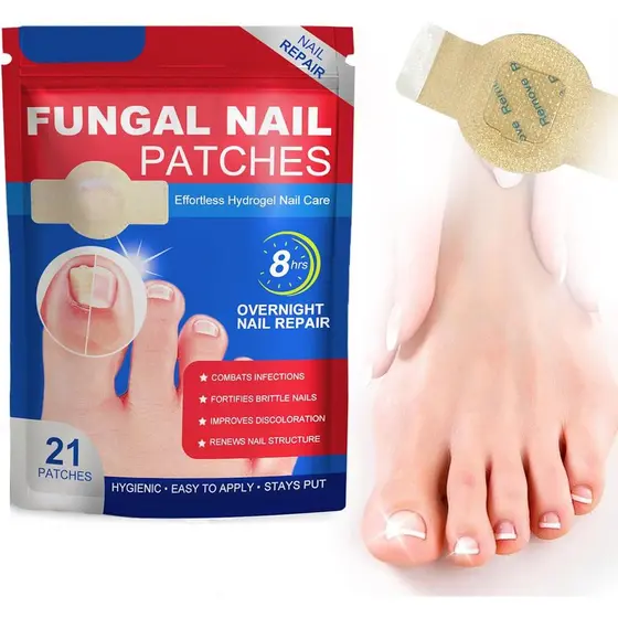 Conjunto de 21 adesivos para fungos nas unhas dos pés, utilizados para tratar infecções fúngicas nas unhas, adesivos par