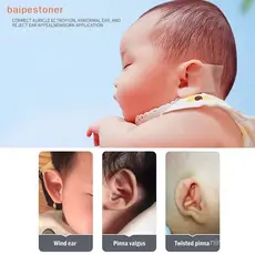 [Corretores De Orelha De Bebê Fita De Silicone Correção Infantil