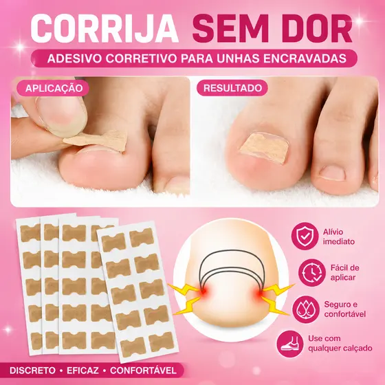 Adesivo Corretor De Unha Encravada Órtese - 40 Unidades