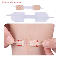HDBR Zipper Fechamento De Feridas Com Fecho Patch Hemostático De Sutura Rápida HDD