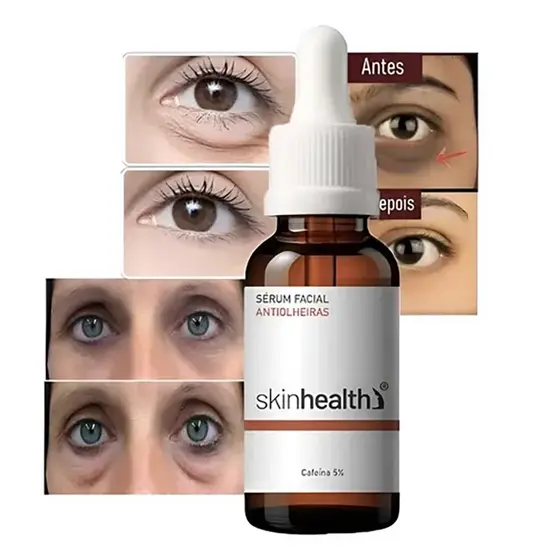 Sérum Para Remover Bolsa Dos Olhos Olheiras Escuras 5% Cafeína 30ml