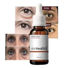 Sérum Para Remover Bolsa Dos Olhos Olheiras Escuras 5% Cafeína 30ml