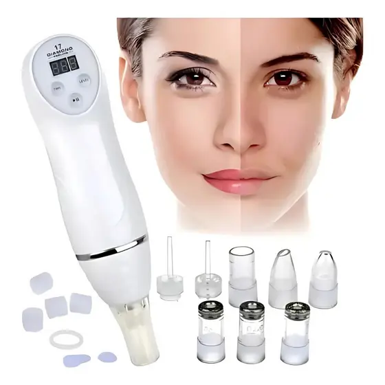 Aparelho Removedor de Cravos e Espinhas Sugador Elétrico Peeling Diamante Limpeza de Pele