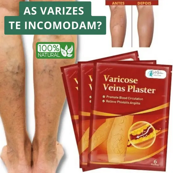 Kit Adesivos Para Varizes Vasos e Veias