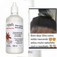 S.O,S CABELO. OLEO DE ANIS ESTRELADO ,CRESCE E NASCE, CRESCIMENTO,BARBA, SOMBRANCELHAS E UNHAS