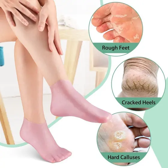 1 Par Meias Cuidados Com Os Pés Spa Uso Doméstico Novo Silicone Calcanhar Gel Hidratante Pé Rachado A Pele Protetores