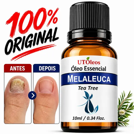 Oleo Essencial de Melaleuca Puro Tea Tree Aroma Intenso Frasco Âmbar Vegano Velas Aromaticas