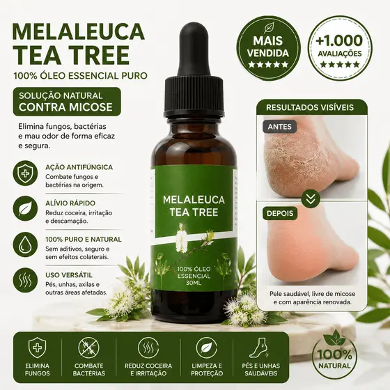 Óleo Essencial Tea Tree Melaleuca 30ml 100% Natural Puro Para Acne Micose Fungos Unhas Aromaterapia