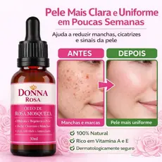 Óleo ROSA MOSQUETA Rubiginosa 30ml Donna Cosméticos 100% Puro Clareia Manchas Cicatrizes Marcas