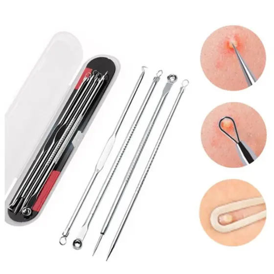 Kit 4 de Ferramentas de Beleza Extrator de Acne Removedor de Cravo Espinha Aço Inoxidável