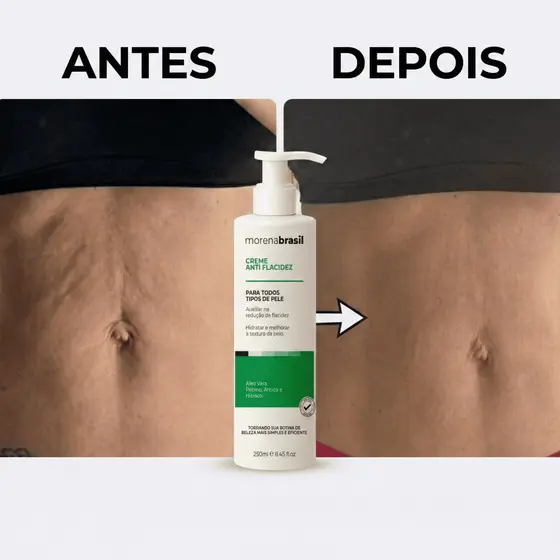 Creme Anti Flacidez Morena Brasil 🦵🏽 Diga Adeus à Flacidez na Barriga, Coxas & Braços 💚💚💚