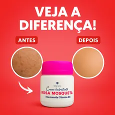 Creme Rosa Mosqueta Facial | Ação Clareadora para Melasma, Acne e Olheiras