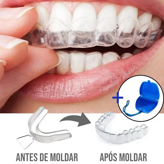 2 unidades (1 par) + Estojo Moldeira Molde Silicone Bruxismo Caseiro Protetor