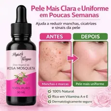 Óleo Vegetal De Rosa Mosqueta 100% Puro Natural Prensado a Frio 30ml