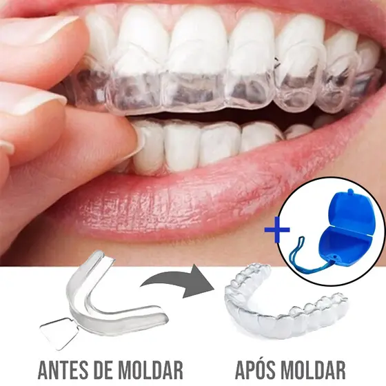 2 unidades (1 par) + Estojo Molde Silicone Bruxismo Caseiro Protetor (não é clareador dental)