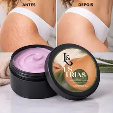 Creme Reduz Estrias Trata E Previne Estrias 150g - L&Beauty