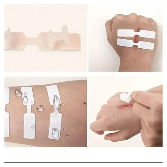 Fita Ponto Falso, Fita Adesiva Ferida, Primeiros Socorros Descartáveis, Sutura Patch, Band Aid, 5pcs