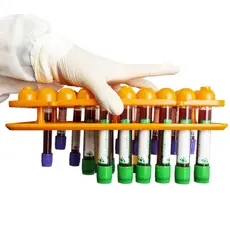 RACK EM ABS COM VENTOSA PARA 50 TUBOS (12 21MM) UNIDADE laboratório análises clínicas pesquisa científica equipamento