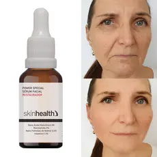 Sérum Restaurador Nano Retinol 3,5% + Niacinamida 5% 30ml Sh