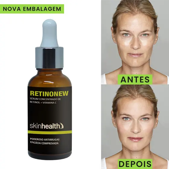 Retinonew Poderoso Antirrugas Eficácia Comprovada Skinhealth