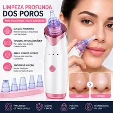 Sugador de Poros Recarregável – Sucção Forte a Vácuo USB para Cravos, Acne e Limpeza Profunda