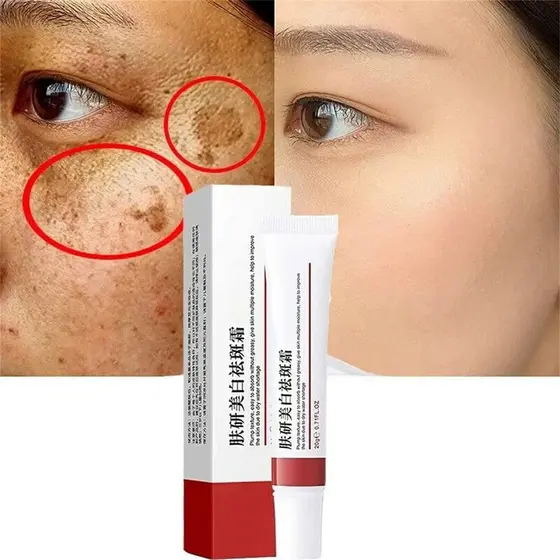 Creme hidratante clareador facial