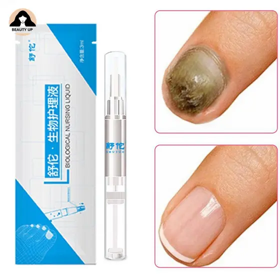 Cuidados Com As Unhas Do Prego Regen Bio-Caneta Fungo Tratamento Unha Fungal Solução De Unhas Prego